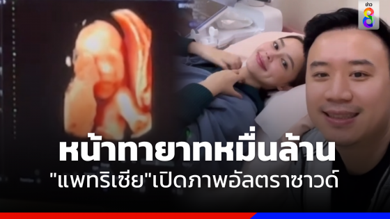 "แพทริเซีย" เปิดภาพอัลตราซาวด์ "ทายาทหมื่นล้าน"