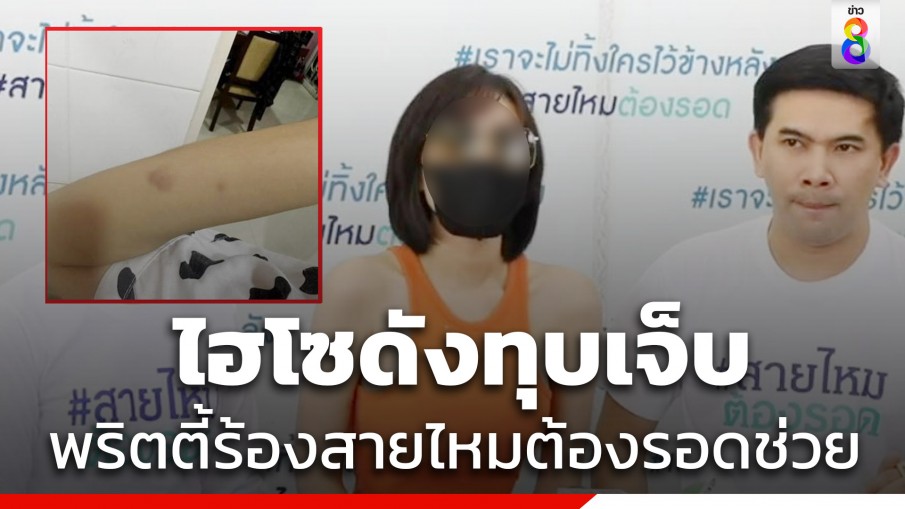 พริตตี้ร้องสายไหมต้องรอดถูกไฮโซชื่อดังแก๊งซูเปอร์คาร์ทำร้ายเจ็บ