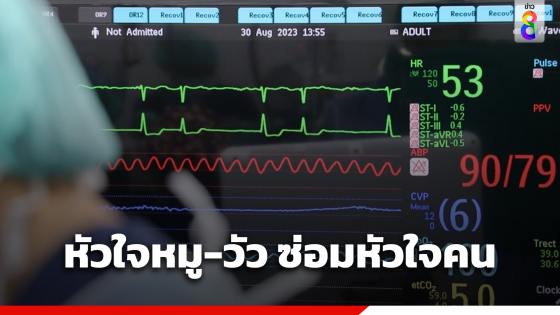 รพ.ศูนย์การแพทย์ ม.วลัยลักษณ์ พัฒนาชิ้นส่วนหัวใจหมู-วัว ซ่อมหัวใจมนุษย์...