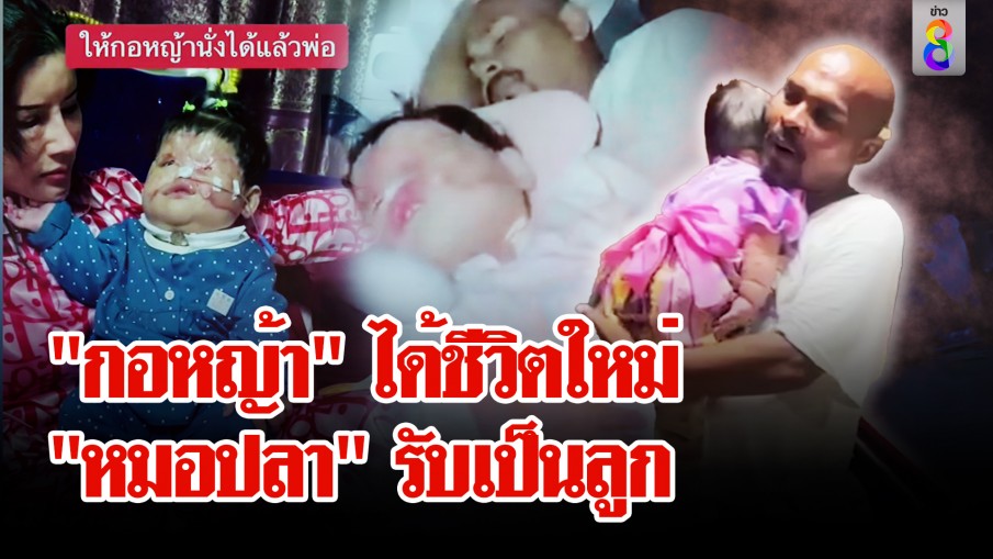 ชีวิตใหม่น้องกอหญ้าถูกสาดน้ำกรด "หมอปลา" ใจพระรับเป็นพ่อบุญธรรม