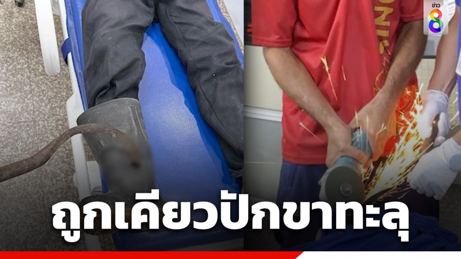 อุทาหรณ์! ลุงวัย 64 ปี รับจ้างตัดหญ้าที่นา ใบมีดหมุนไปถูกเคียวเกี่ยวข้าว ปักขาทะลุ