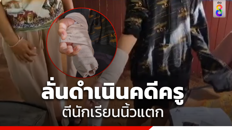 ครูตีเด็กนิ้วมือแตก ล่าสุดครูเข้ากราบขอโทษ แต่ผู้ปกครองไม่ยอม ยืนยันดำเนินคดีกับครูถึงที่สุด