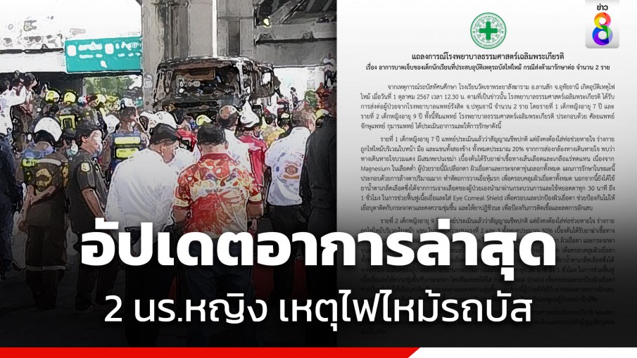 รพ.ธรรมศาสตร์ฯ แถลงอาการล่าสุด 2 นักเรียนหญิง บาดเจ็บจากไฟไหม้รถบัส