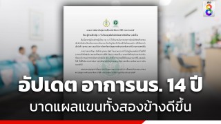 รพ.เด็ก อัปเดตอาการนักเรียน 14 ปี บาดเจ็บเหตุไฟไหม้รถบัส บาดแผลแขนทั้งสองข้างดีขึ้น...