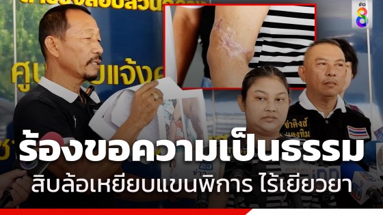 อดีตตลก พาญาติร้องกองปราบฯ ถูกสิบล้อเหยียบแขนพิการ ตำรวจฟันประมาทร่วม...